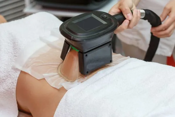 Image of person having fat freezing treatment to help weight gain Stockport