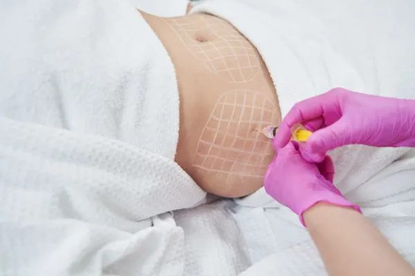 image of fat dissolving injections on love handles to help combat weight gain Stockport